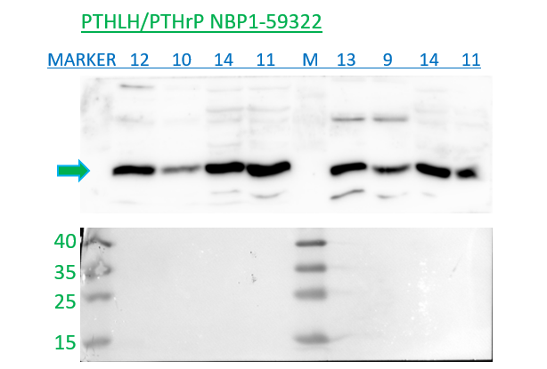 PTHLH/PTHrP Antibody
