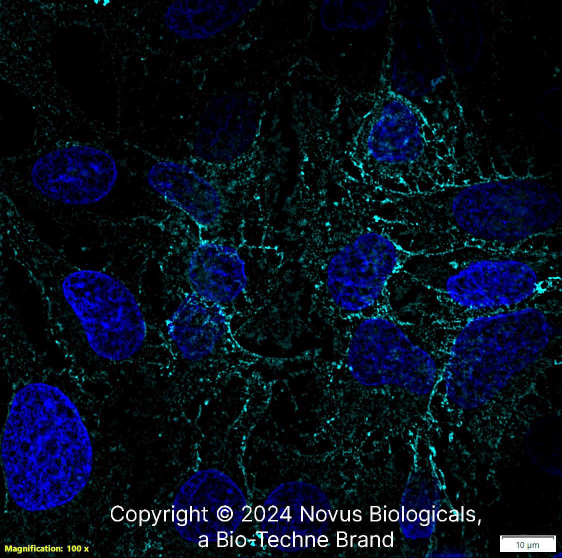 MCT1/SLC16A1 Antibody - BSA Free