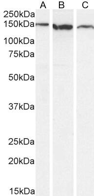 EVI-1 Antibody