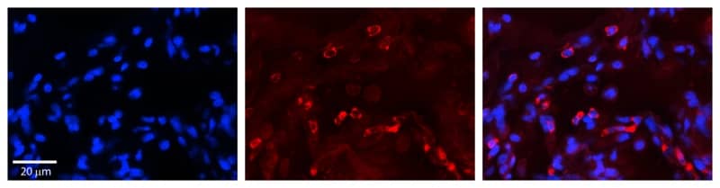 LYAG/GAA Antibody - BSA Free