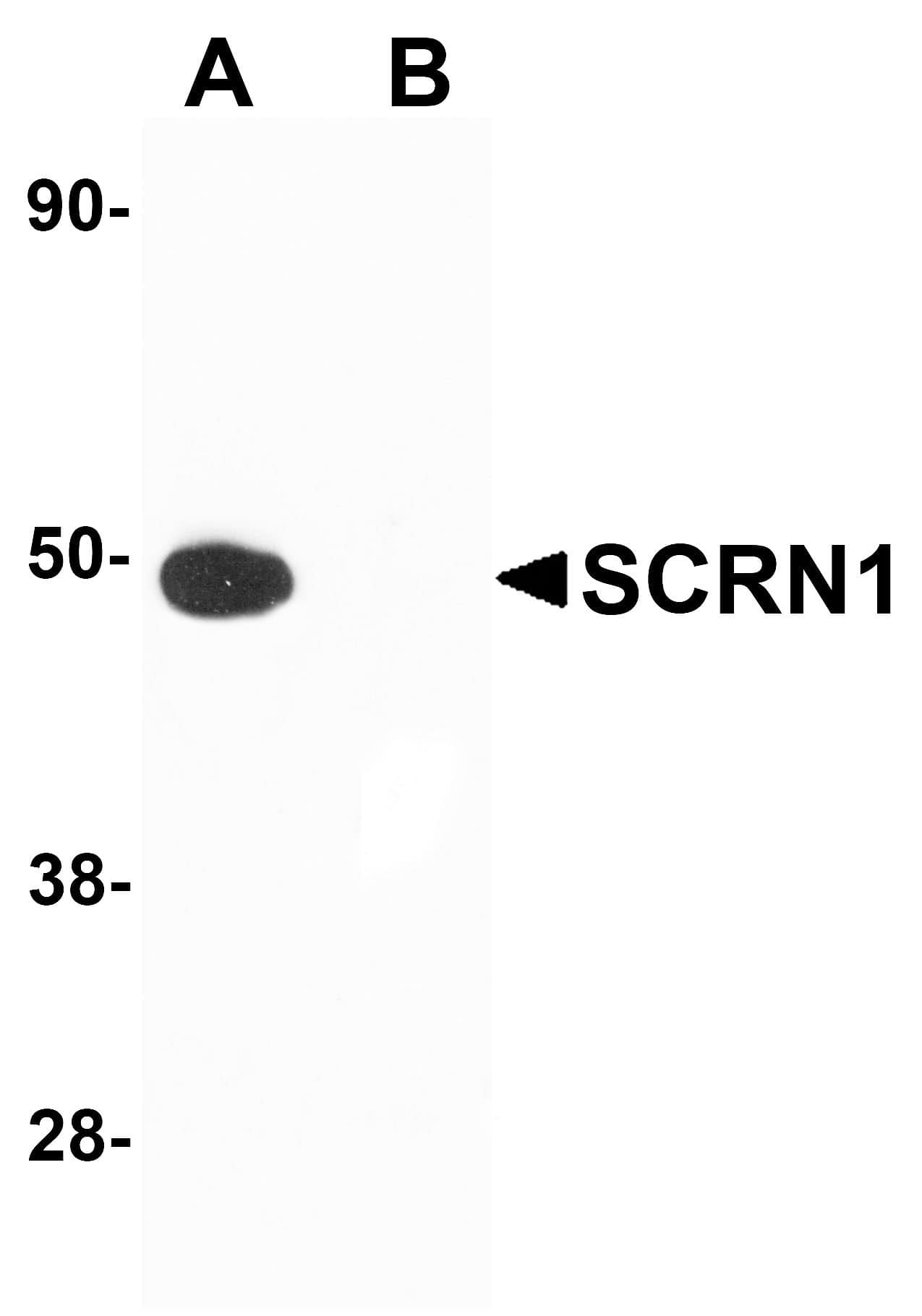 Secernin-1 Antibody - BSA Free