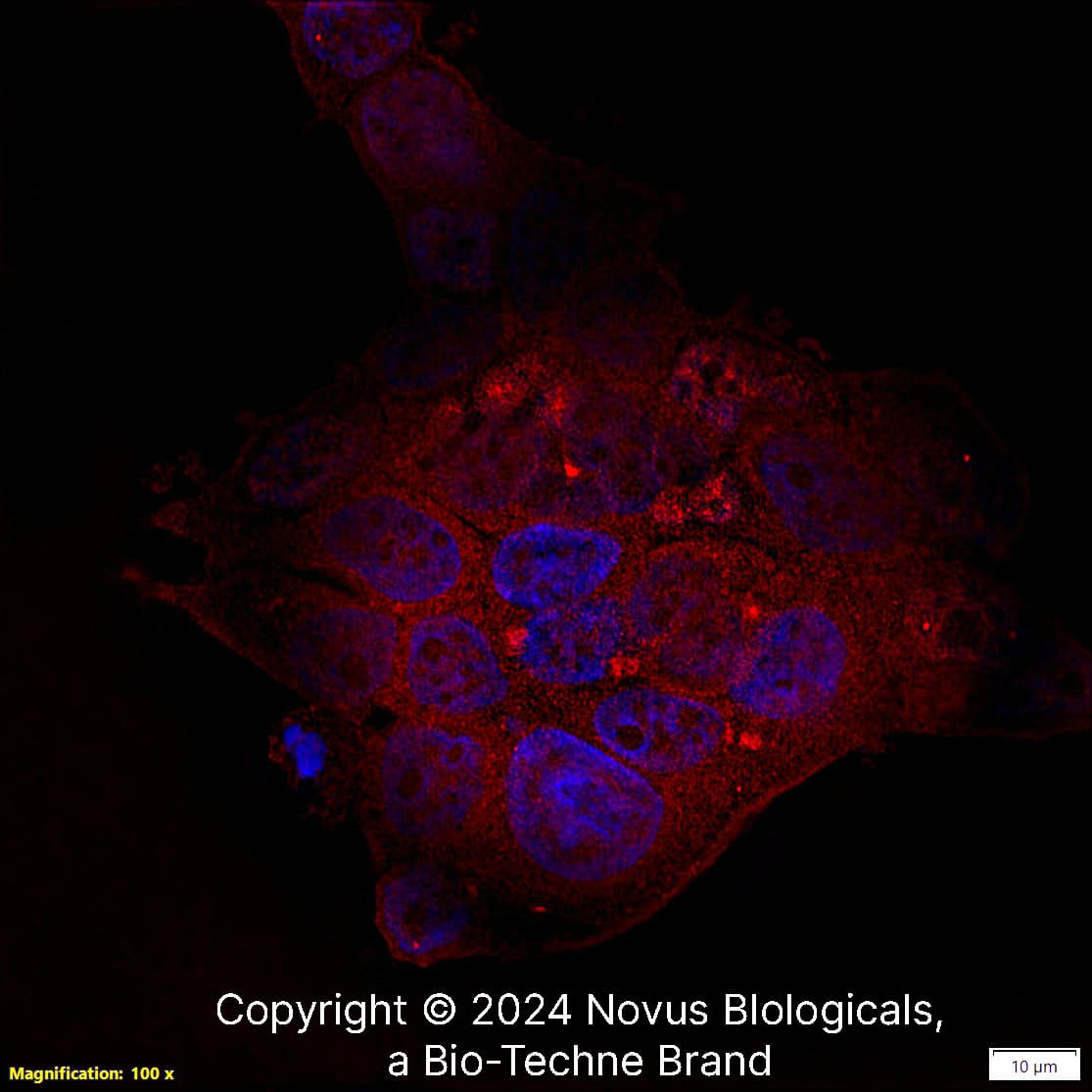 PIEZO1 Antibody BSA Free (NBP178446) by Novus, Part of BioTechne