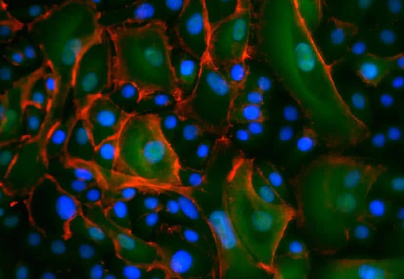 PIEZO1 Antibody - BSA Free