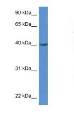 ZDHHC11/ZDHHC11B Antibody