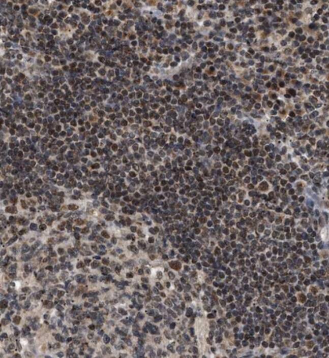 ZBTB11 Antibody - BSA Free