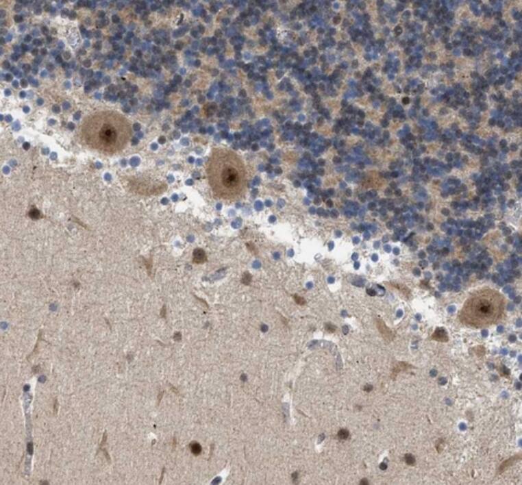 ZBTB11 Antibody - BSA Free