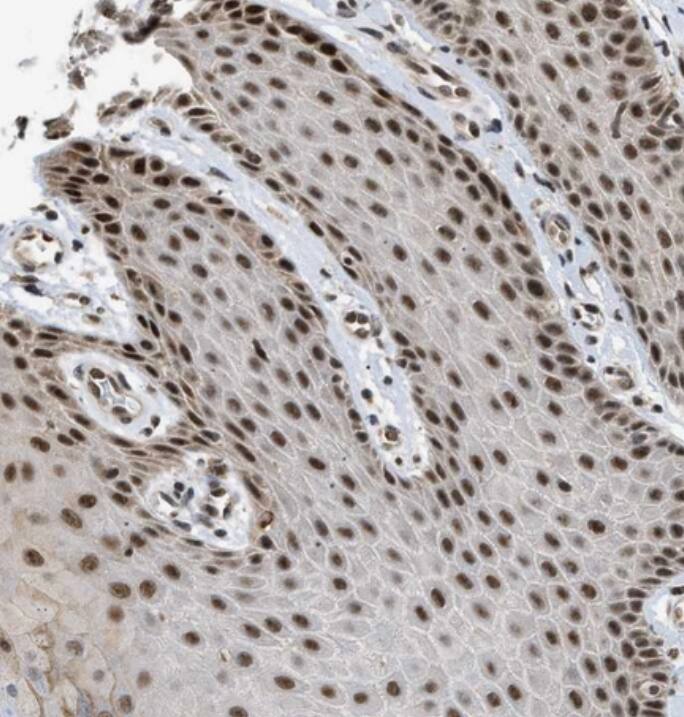 ZBTB11 Antibody - BSA Free