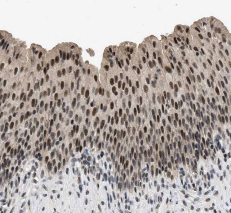 ZBTB11 Antibody - BSA Free