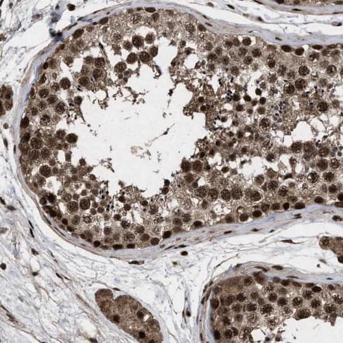 WIZ Antibody - BSA Free Immunohistochemistry-Paraffin: WIZ Antibody [NBP1-80586]
