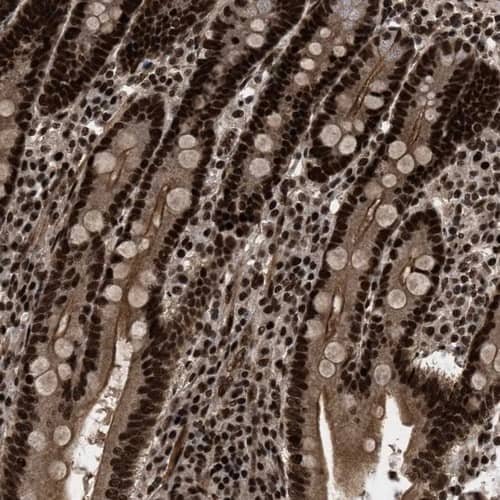 WIZ Antibody - BSA Free Immunohistochemistry-Paraffin: WIZ Antibody [NBP1-80586]