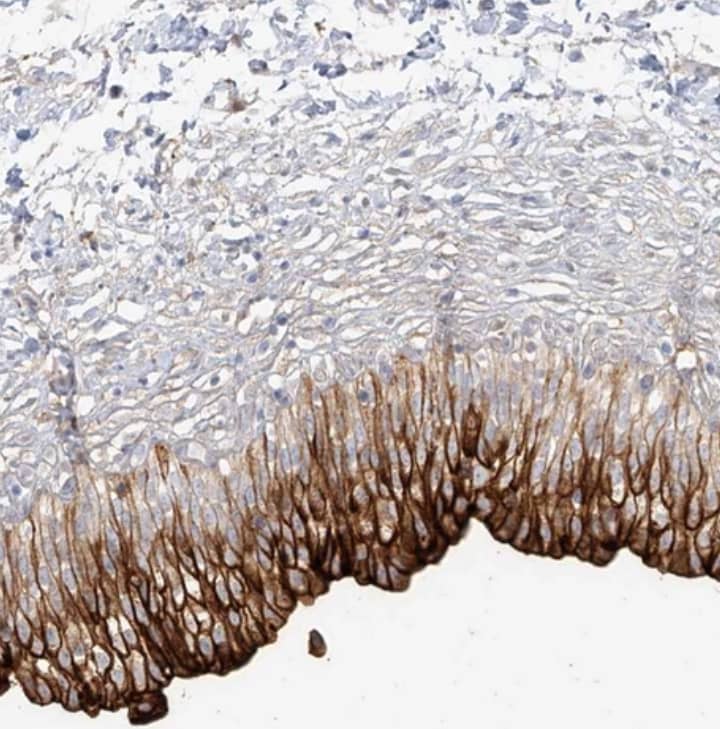 Uroplakin Ib Antibody - BSA Free