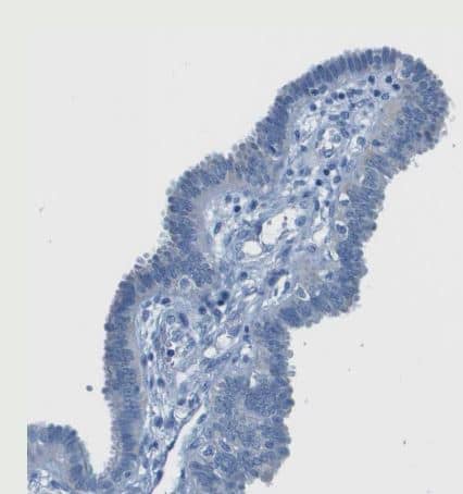 SLC16A10 Antibody