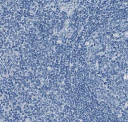 SLC16A10 Antibody
