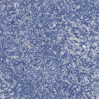 SLC10A6 Antibody