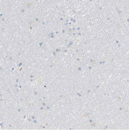 Serine protease 23 Antibody