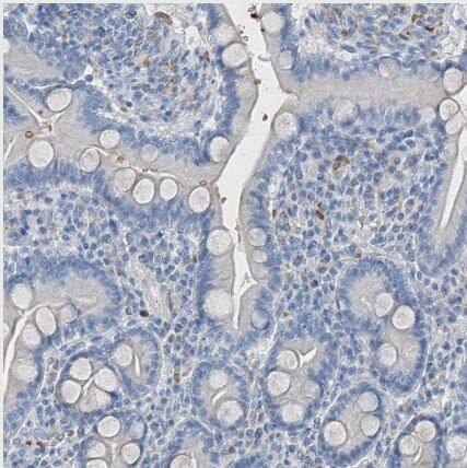 Serine protease 23 Antibody