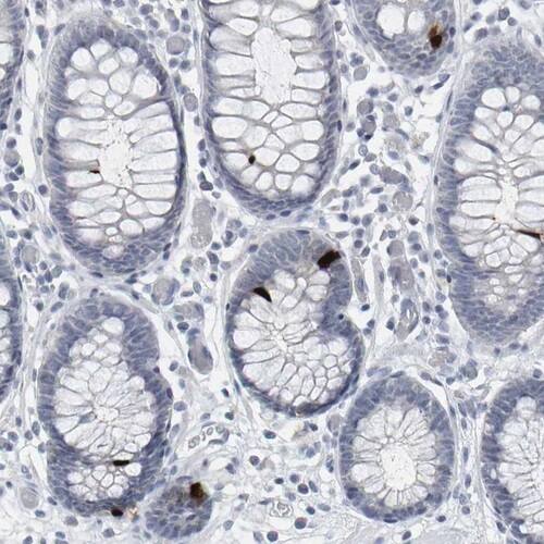 Peptide YY Antibody - BSA Free Immunohistochemistry-Paraffin: Peptide YY Antibody [NBP1-80865]