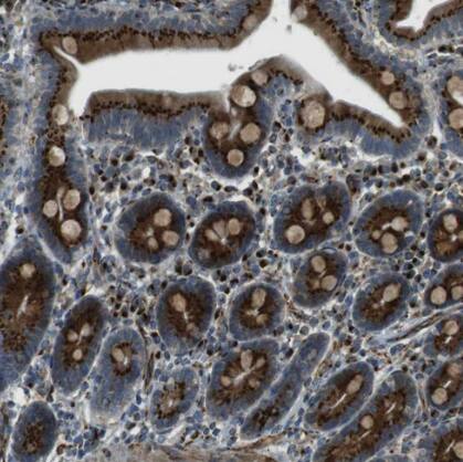 TMEM115 Antibody - BSA Free