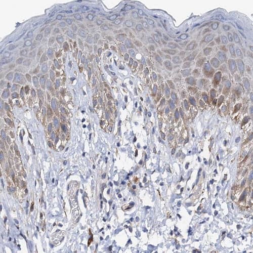 PAMCI Antibody - BSA Free Immunohistochemistry: PAMCI Antibody [NBP1-80938]
