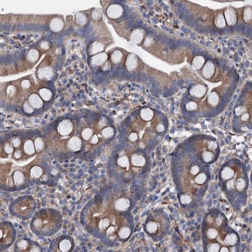PAMCI Antibody - BSA Free Immunohistochemistry: PAMCI Antibody [NBP1-80938]