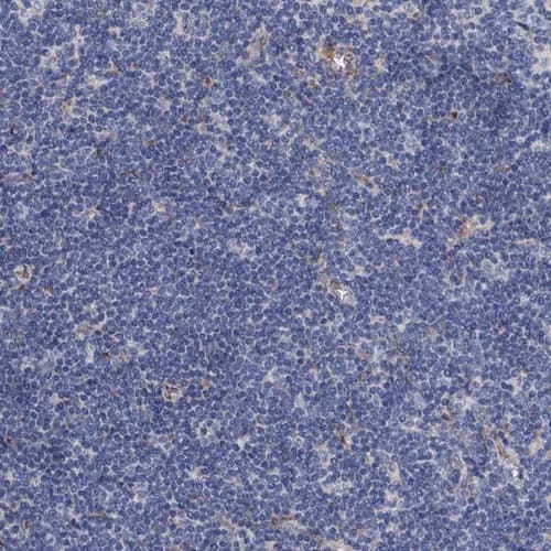 PAMCI Antibody - BSA Free Immunohistochemistry: PAMCI Antibody [NBP1-80938]