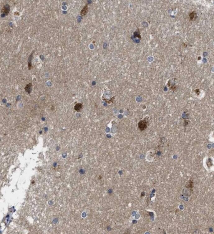 Polycystin 2 Antibody - BSA Free