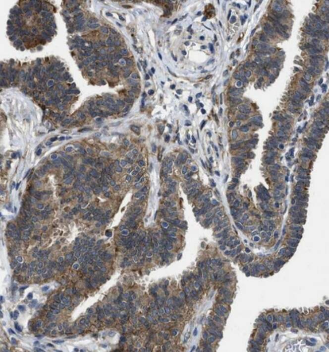 Polycystin 2 Antibody - BSA Free