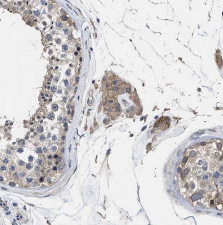 Polycystin 2 Antibody - BSA Free