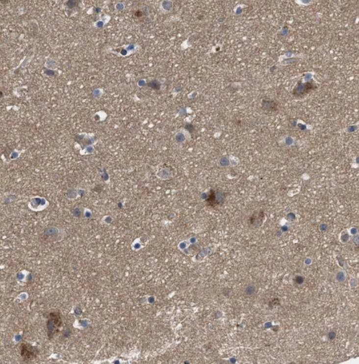 Polycystin 2 Antibody - BSA Free