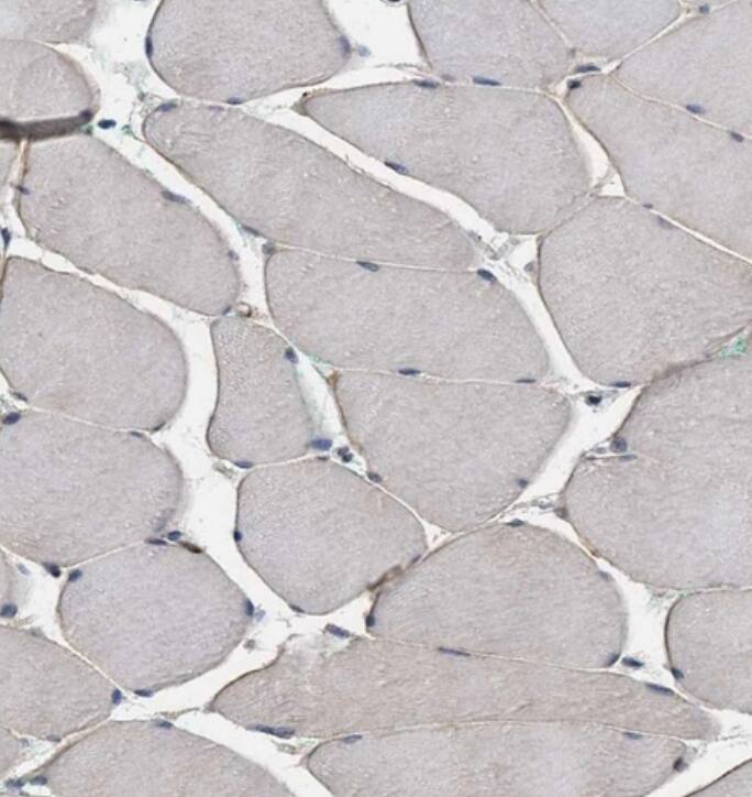 Polycystin 2 Antibody - BSA Free