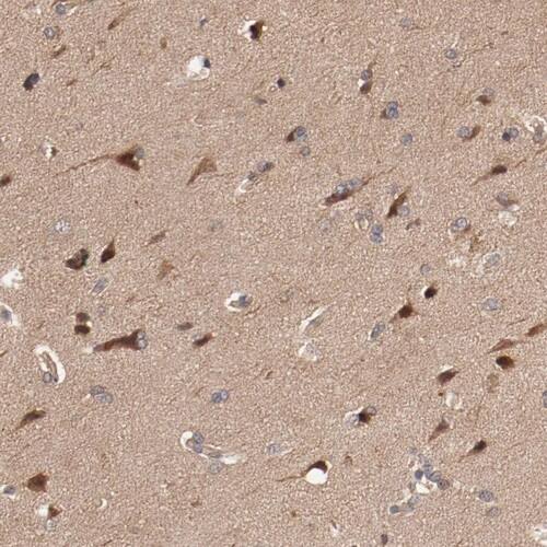 PITPNM2 Antibody - BSA Free Immunohistochemistry-Paraffin: PITPNM2 Antibody [NBP1-80995]
