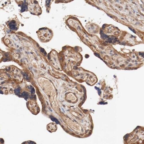 PITPNM2 Antibody - BSA Free Immunohistochemistry-Paraffin: PITPNM2 Antibody [NBP1-80995]