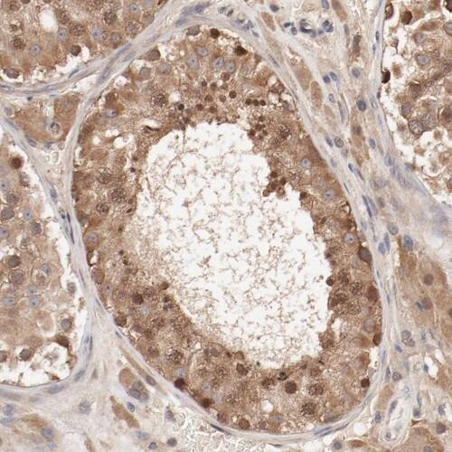 PITPNM2 Antibody - BSA Free Immunohistochemistry-Paraffin: PITPNM2 Antibody [NBP1-80995]
