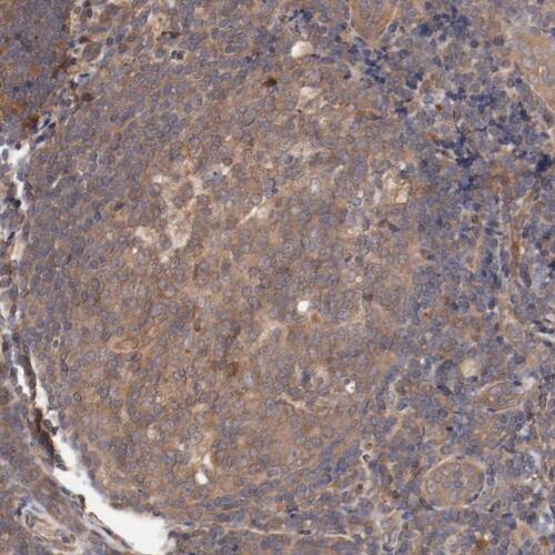 PITPNM2 Antibody - BSA Free Immunohistochemistry-Paraffin: PITPNM2 Antibody [NBP1-80995]