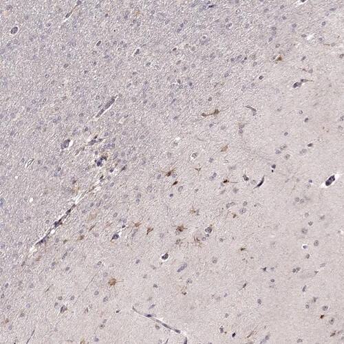 EGR4 Antibody - BSA Free Immunohistochemistry-Paraffin: EGR4 Antibody [NBP1-80999]