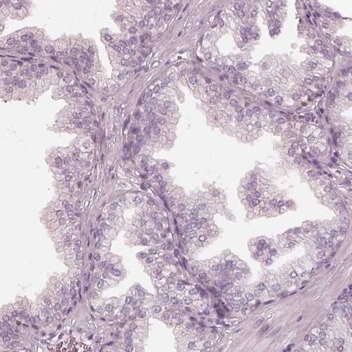 EGR4 Antibody - BSA Free Immunohistochemistry-Paraffin: EGR4 Antibody [NBP1-80999]