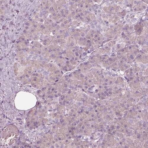EGR4 Antibody - BSA Free Immunohistochemistry-Paraffin: EGR4 Antibody [NBP1-80999]