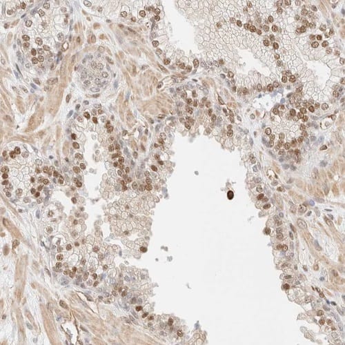 ARID5A Antibody - BSA Free Immunohistochemistry-Paraffin: ARID5A Antibody [NBP1-81037]
