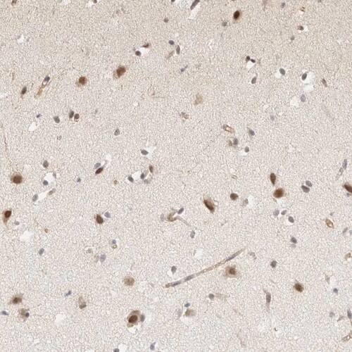 ARID5A Antibody - BSA Free Immunohistochemistry-Paraffin: ARID5A Antibody [NBP1-81037]