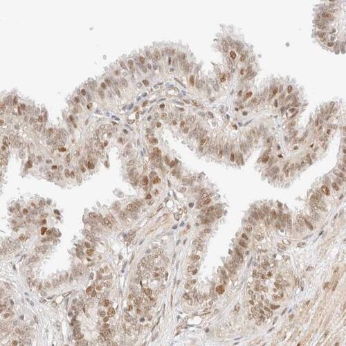 ARID5A Antibody - BSA Free Immunohistochemistry-Paraffin: ARID5A Antibody [NBP1-81037]