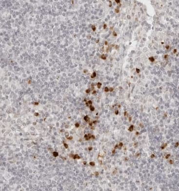 ZNF678 Antibody - BSA Free