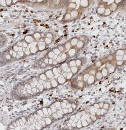 ZNF678 Antibody - BSA Free