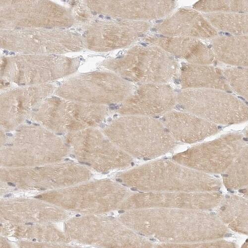 TSEN2 Antibody - BSA Free Immunohistochemistry-Paraffin: TSEN2 Antibody [NBP1-81141]