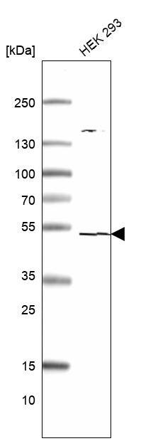 TSEN2 Antibody - BSA Free Western Blot: TSEN2 Antibody [NBP1-81141]