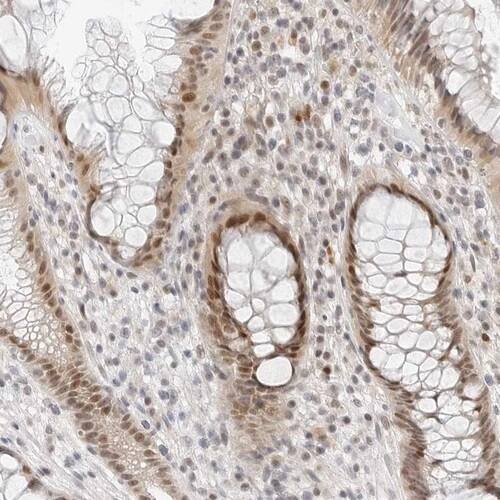 TSEN2 Antibody - BSA Free Immunohistochemistry-Paraffin: TSEN2 Antibody [NBP1-81141]