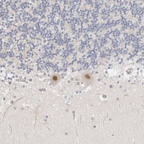 TSEN2 Antibody - BSA Free Immunohistochemistry-Paraffin: TSEN2 Antibody [NBP1-81141]