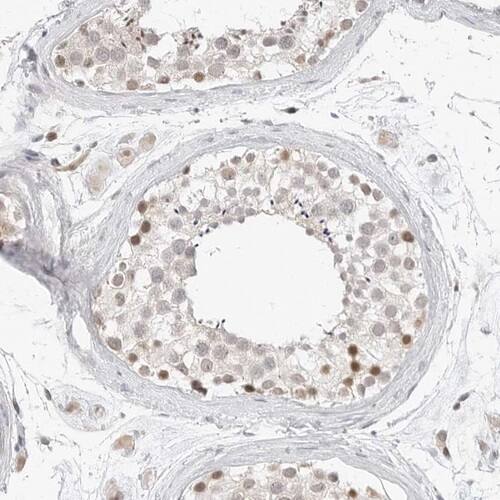 TSEN2 Antibody - BSA Free Immunohistochemistry-Paraffin: TSEN2 Antibody [NBP1-81141]
