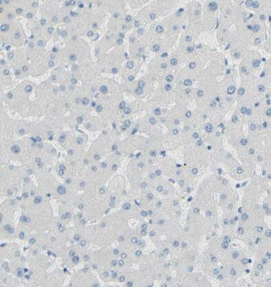 TMIGD2 Antibody