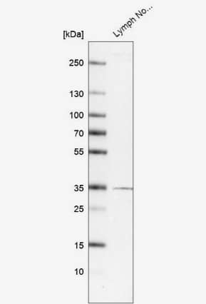 TMIGD2 Antibody