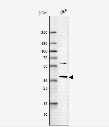 RNF166 Antibody